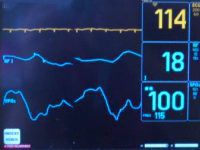 monitor puls tętno
