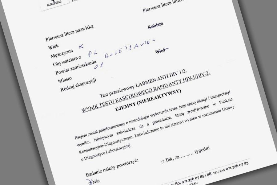 test hiv