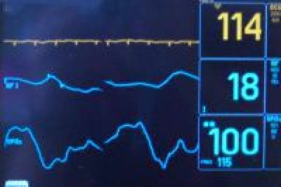 monitor puls tętno