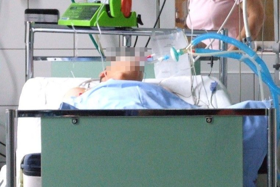 szpital intubacja oiom