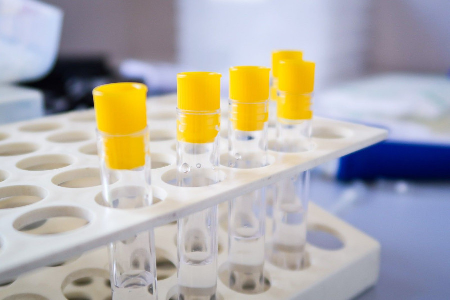 laboratorium koronawirus