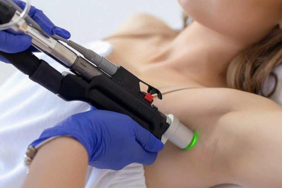 epilacja kobieta pacha