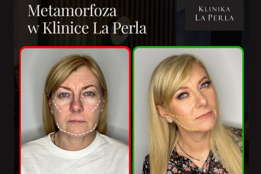 metamorfoza la perla bolesławiec