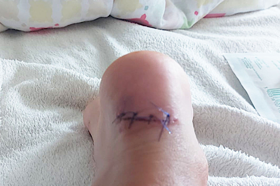 rana basen park wodny