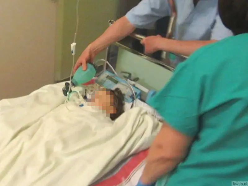 Lekarze kilka godzin walczyli o życie maluszka. Na zdjęciu widać, jak lekarz ręcznie dostarcza powietrze, gdy dziecko jest przewożone na Oddział Intensywnej Opieki Medycznej