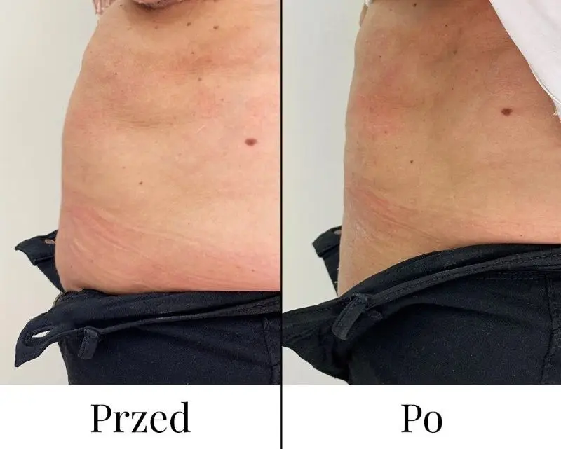 Dual Lift – podwójna moc rewitalizacji