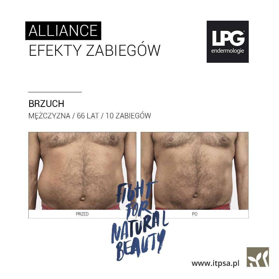 Zabiegi w Dom Urody Bolesławiec