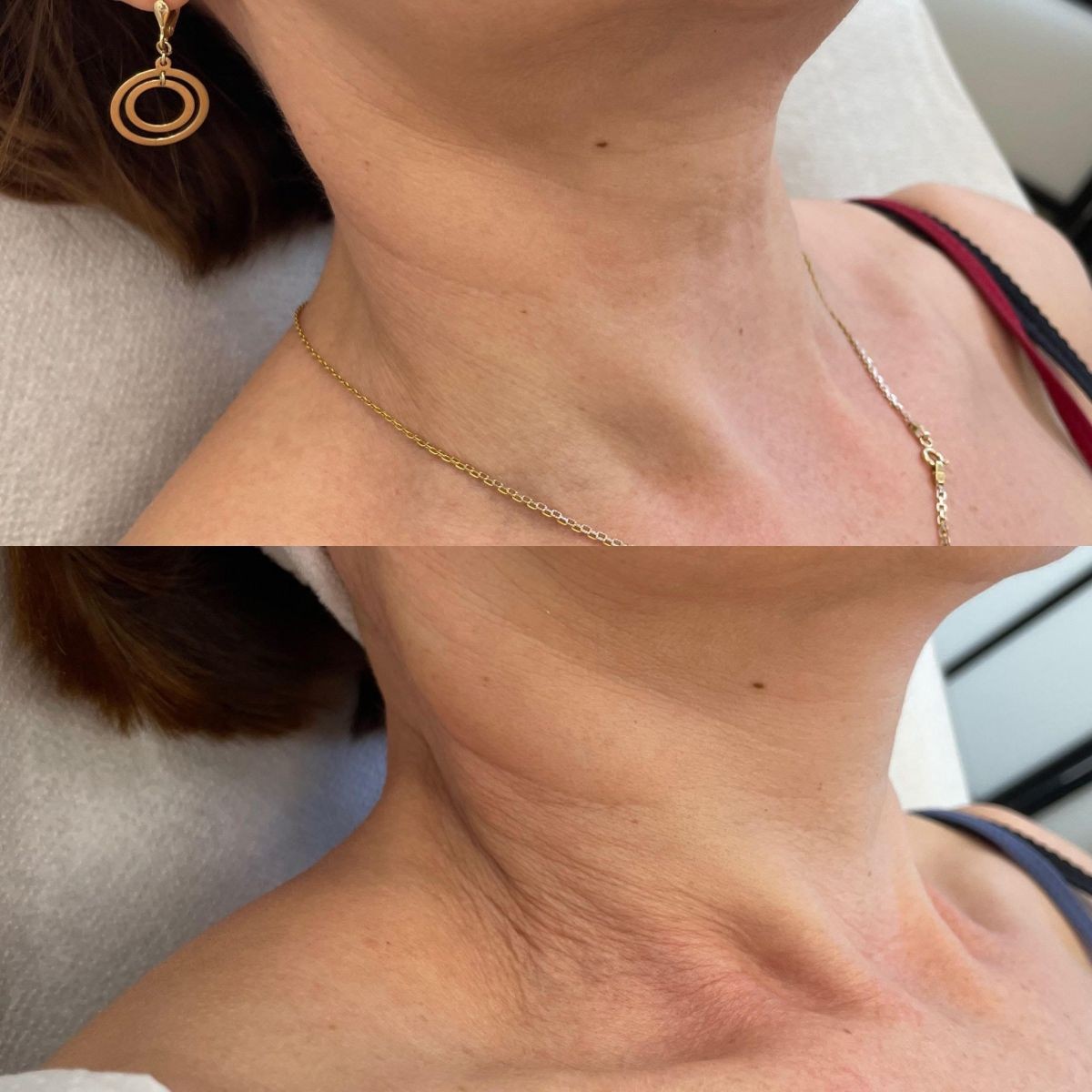 Efekty zabiegu uzyskane w Domu Urody