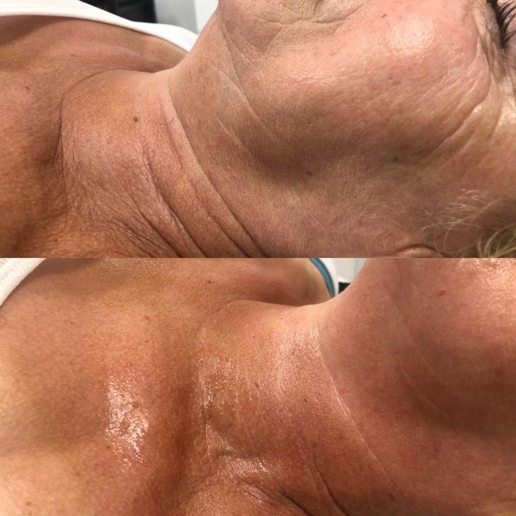 Efekty zabiegu uzyskane w Domu Urody