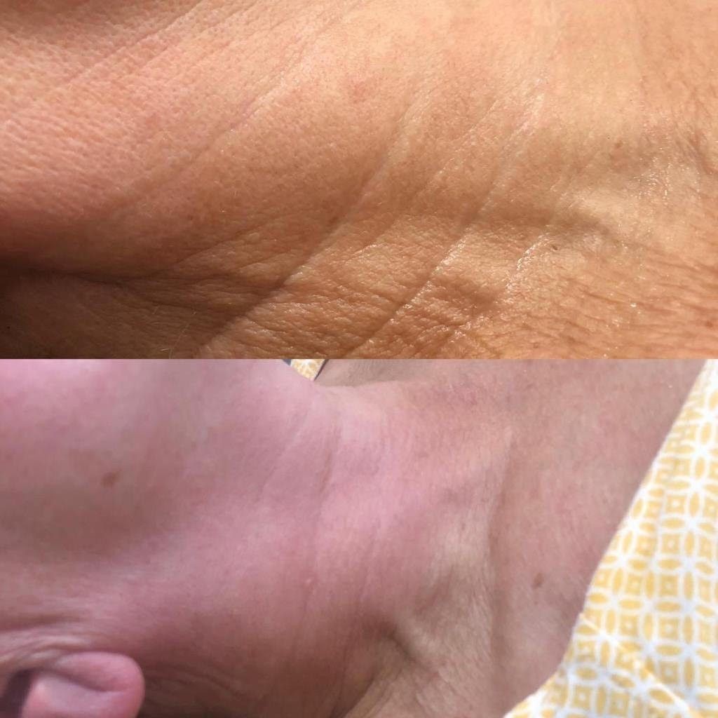 Efekty zabiegu uzyskane w Domu Urody