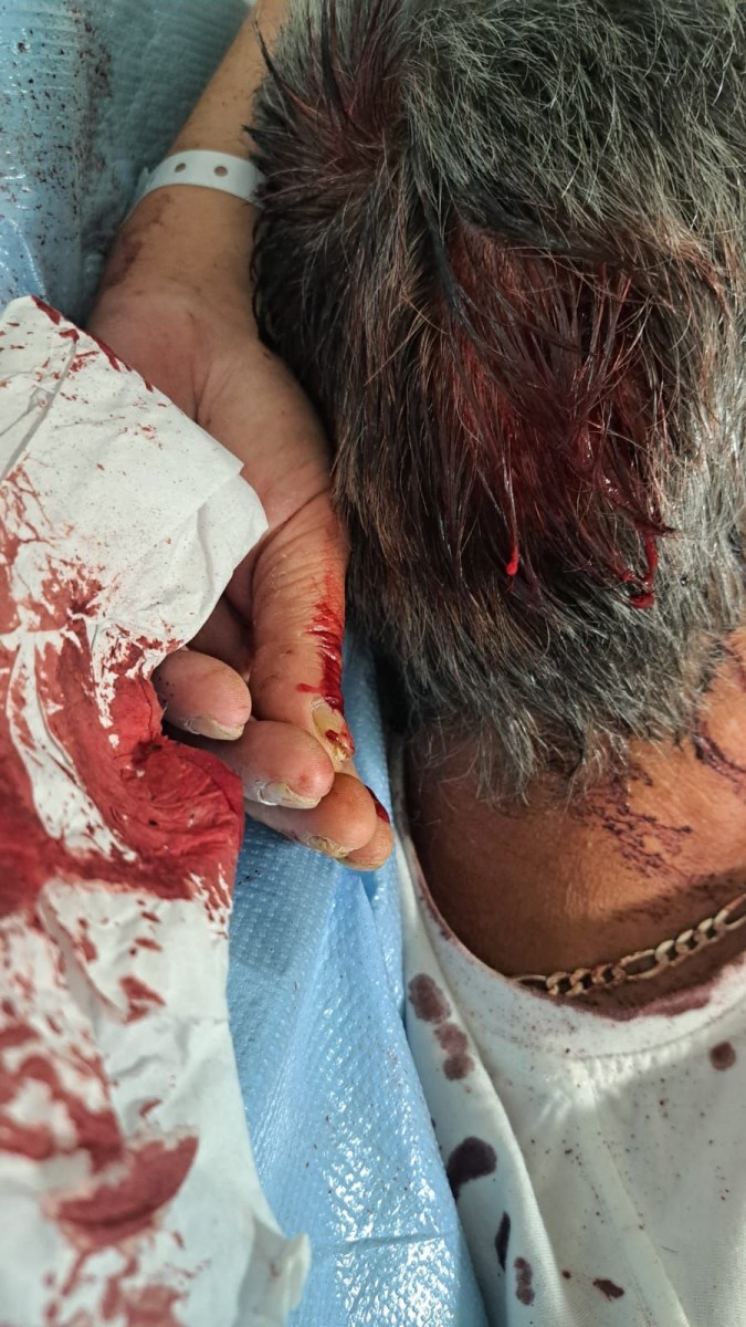 Potrącony rowerzysta