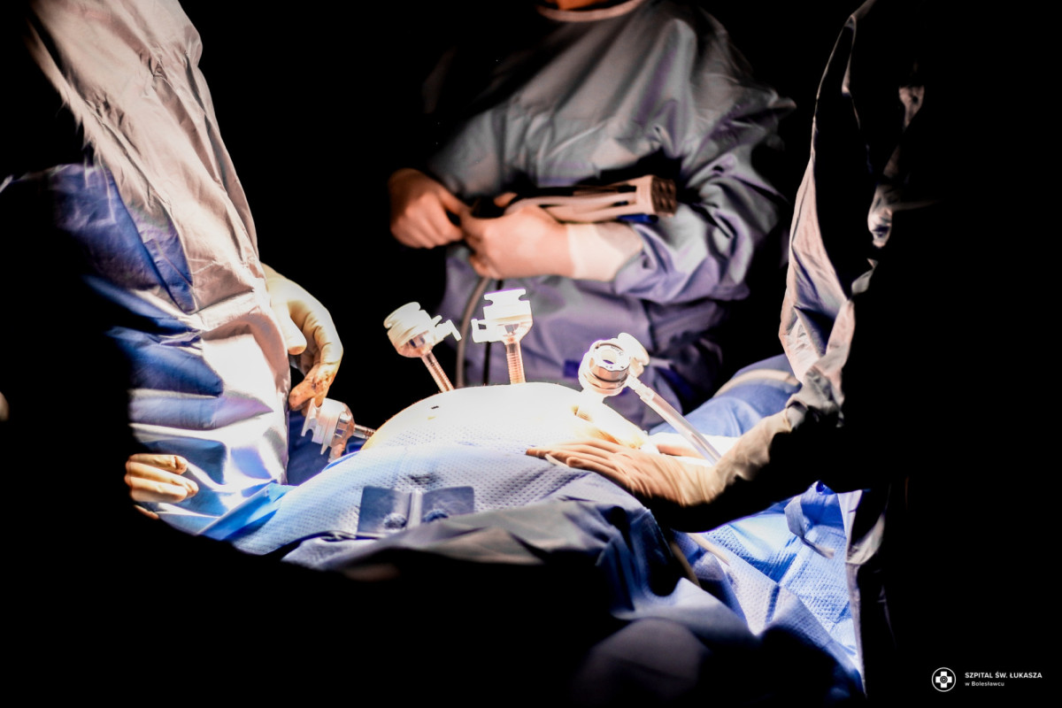 Operacja w bolesławieckim szpitalu przy pomocy robota HUGO™ RAS