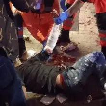 Zobacz zdjęcie: Męzczyzna okaleczył się przed Dino