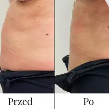 Zobacz zdjęcie: Dual Lift – podwójna moc rewitalizacji